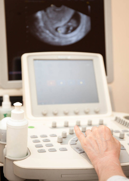 Doctor performing an ultrasound examination - 写真・画像