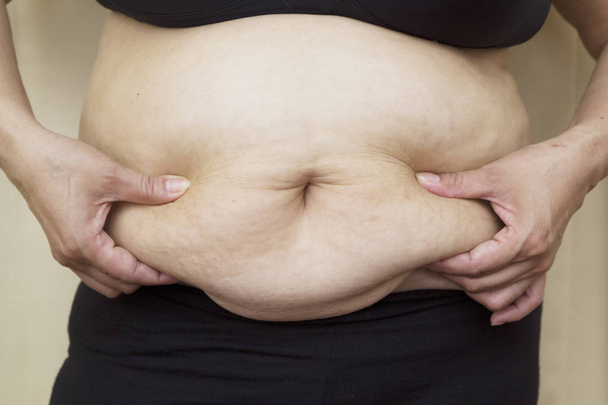 Fat female body part. - Photo, Image