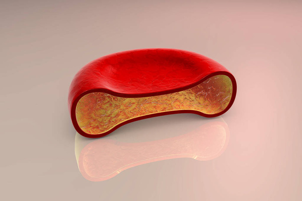 Sección transversal de glóbulos rojos
 - Foto, imagen