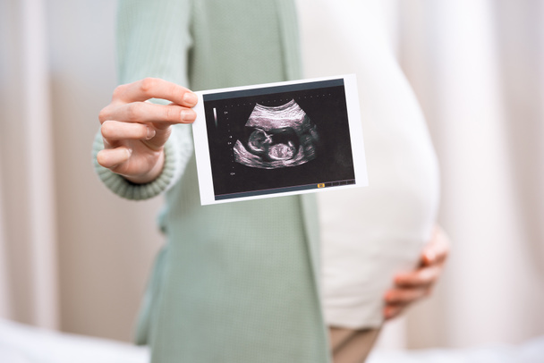 Mujer embarazada sosteniendo la exploración del bebé 3
 - Foto, imagen