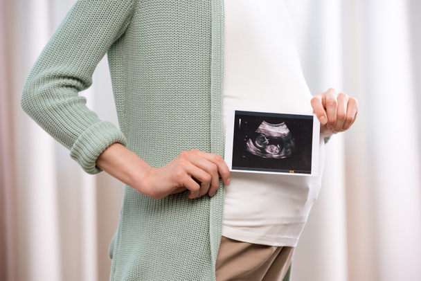 Mujer embarazada con ecografía del bebé
 - Foto, imagen