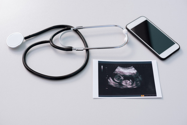 fonendoskop s výsledkem vyšetřování ultrazvukem a smartphone - Fotografie, Obrázek