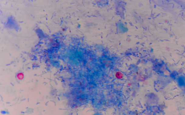 ovocito de criptosporidium de glóbulos rojos
 - Foto, imagen