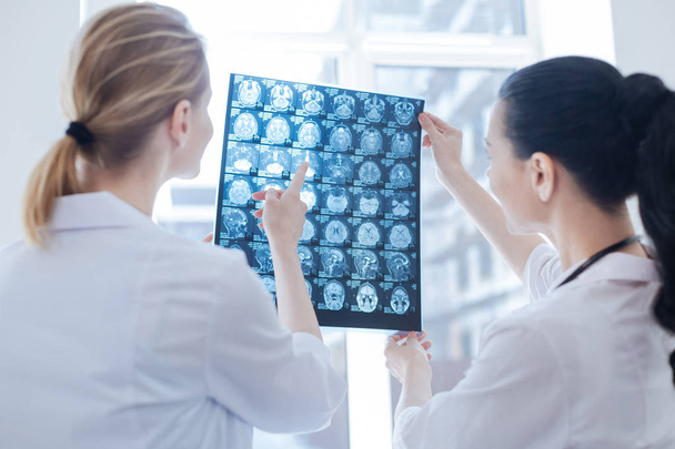 Optimistic neurologists analyzing x ray photo at the roentgen cabinet - Fotó, kép