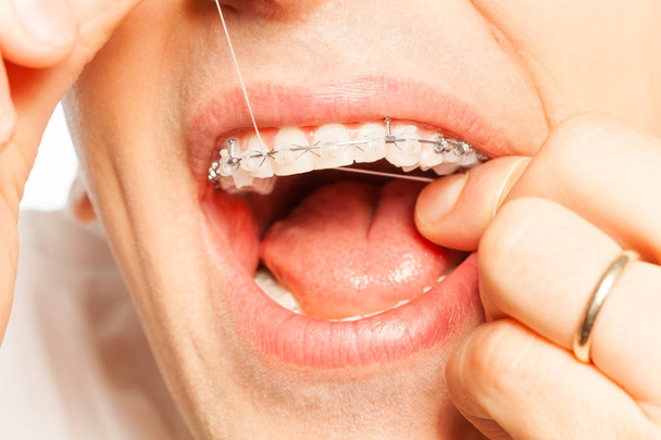 Man with braces using dental floss - Fotografie, Obrázek