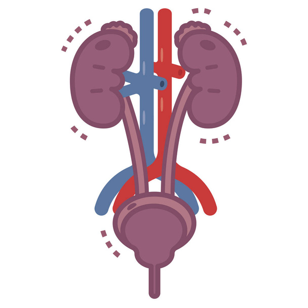 Illustrazione di urologia malata
 - Vettoriali, immagini