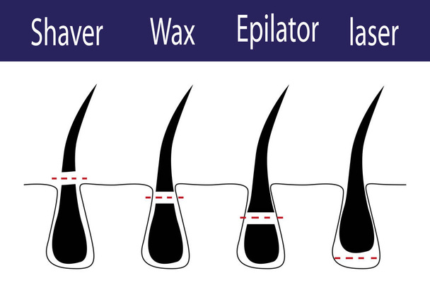 Schemat wektorowy różnych metod usuwania włosów - Wektor, obraz