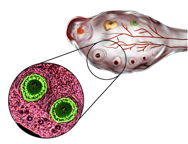Поперечное сечение яичника
 - Фото, изображение