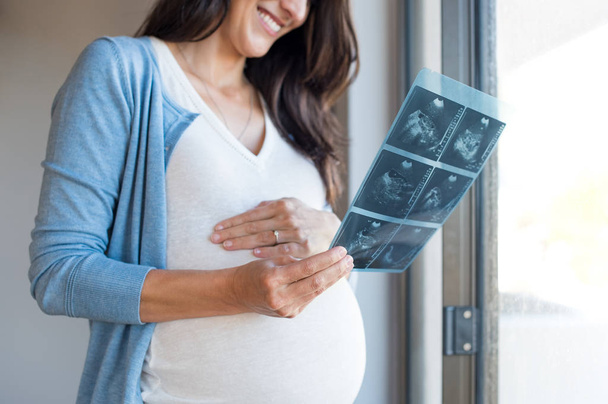 Pregnant woman holding ultrasound - Fotó, kép