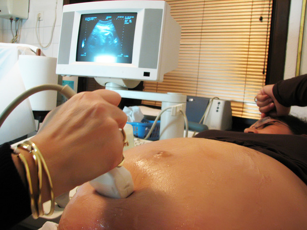 ultrazvukové kontroly - Fotografie, Obrázek