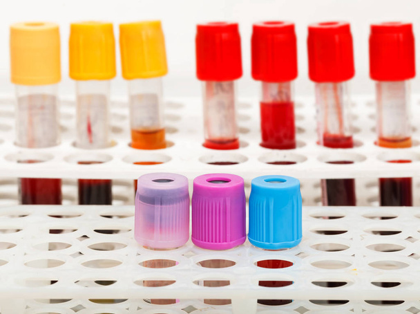 Blood sample tubes - Foto, imagen