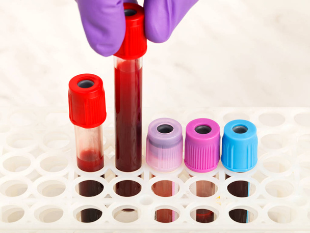 General blood test - Foto, imagen