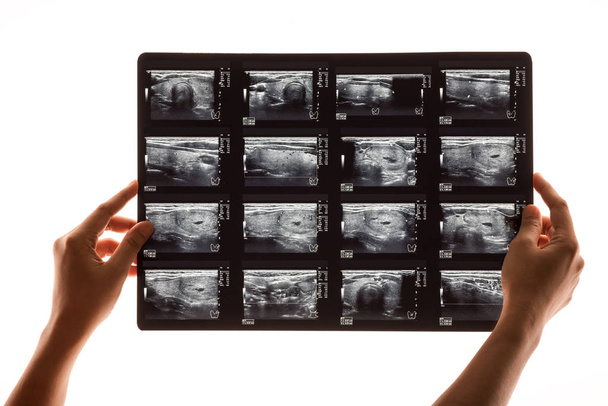 Ultraschalluntersuchung der Schwangerschaft - Foto, Bild