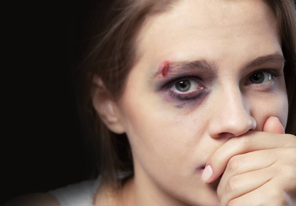 Woman victim of domestic violence  - Fotó, kép