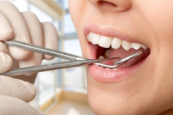 Woman teeth and a dentist mouth mirror - Foto, Imagem
