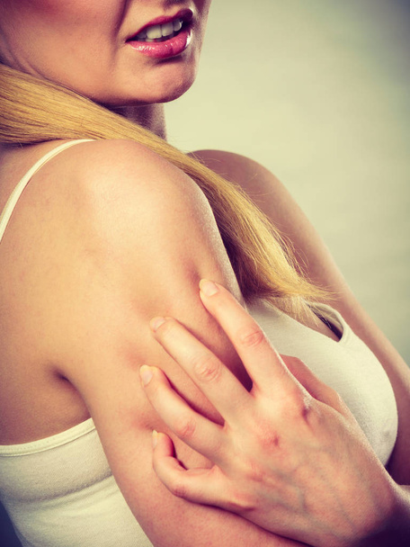 woman scratching her itchy arm with allergy rash - Photo, Image
