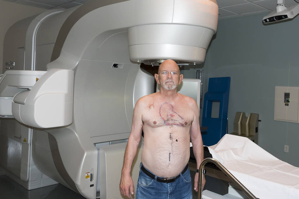 Radiation Cancer Patient Targeted for treatment - Photo, Image