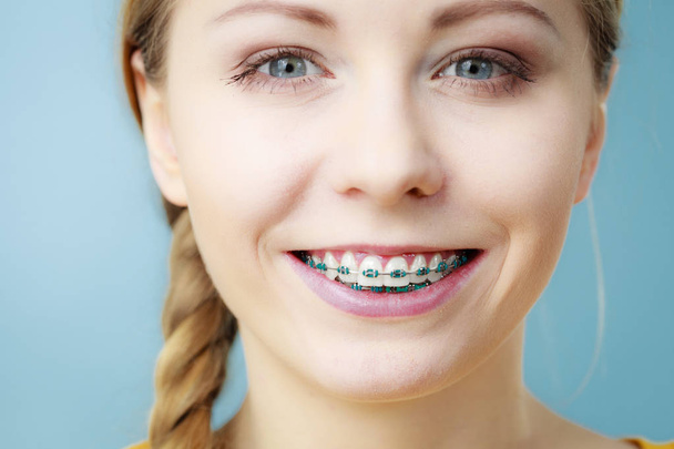 Young woman showing teeth braces - Zdjęcie, obraz