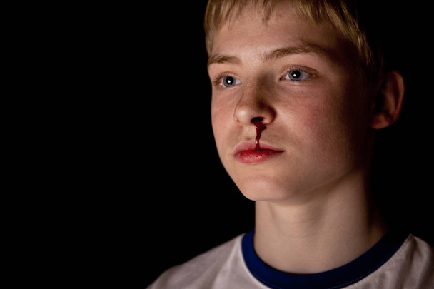 Jeune garçon blond au nez sanglant
 - Photo, image
