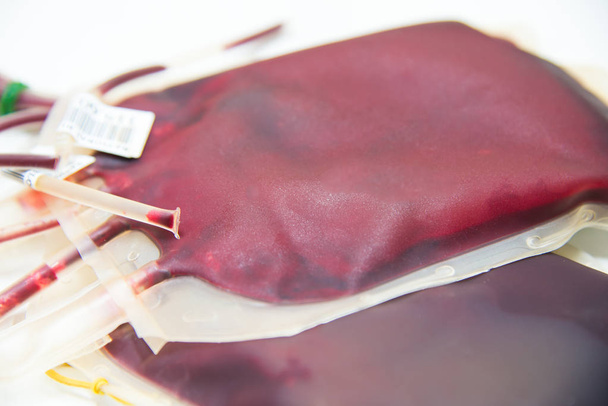 червоний мішок крові в лабораторії
 - Фото, зображення