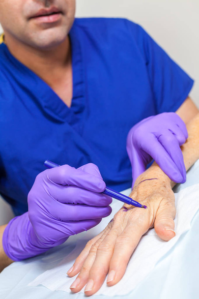 Plasztikai sebész orvos jelölés keze vezető nő a műtét - Fotó, kép
