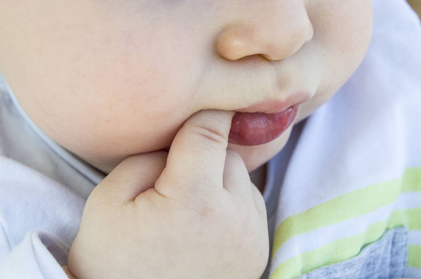 Baby's tandextractie en zuigen vingers foto 's, - Foto, afbeelding