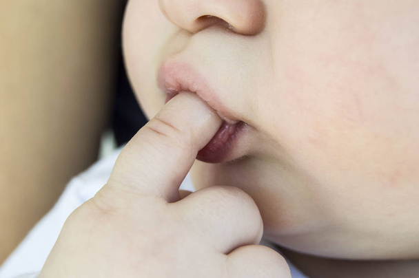 Extrakce zubu a sání prstů obrázky dítěte, - Fotografie, Obrázek