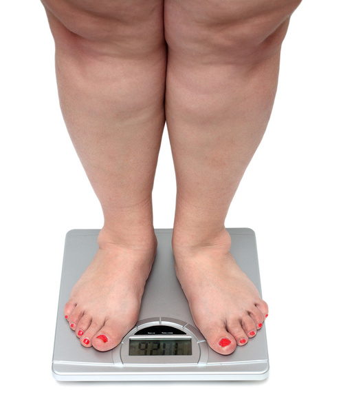 Frauenbeine mit Übergewicht - Foto, Bild