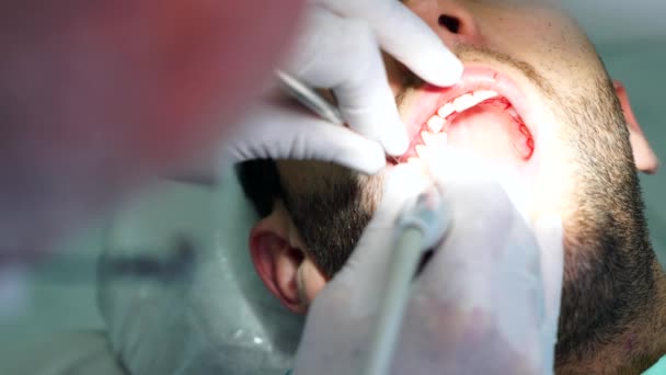 Dentist curing a male patient - Кадри, відео