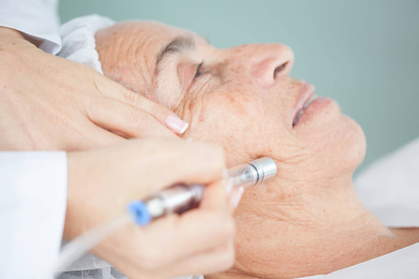Microdermabrasion treatment on a senior woman - Photo, Image