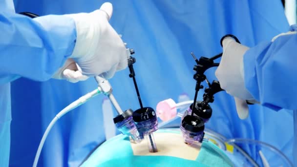 χειρουργική επέμβαση εκτελείται από χειρουργούς  - Πλάνα, βίντεο
