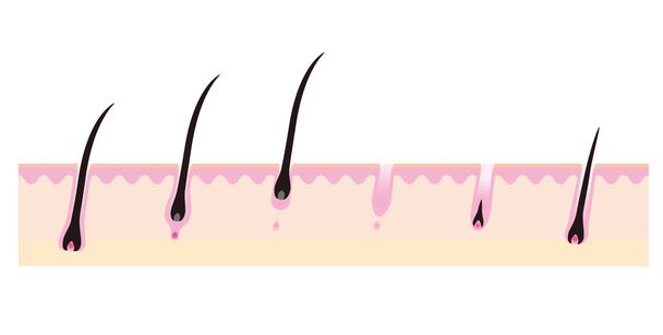 Bosquejo de imagen en el ciclo de crecimiento del cabello
 - Vector, imagen