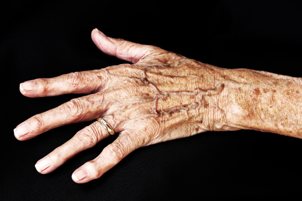 La main d'une vieille femme
 - Photo, image