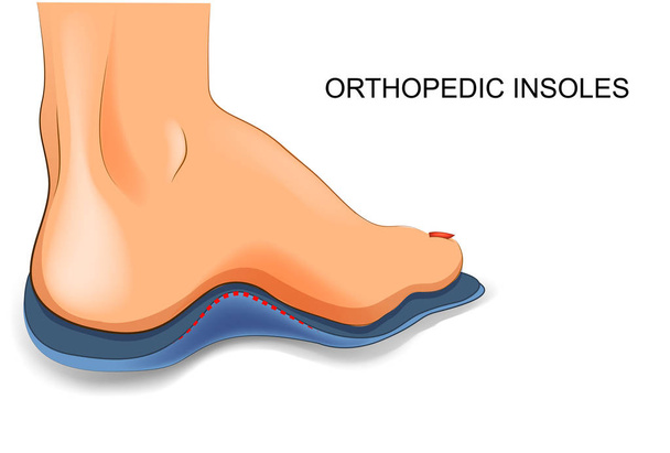 Wkładki ortopedyczne do butów - Wektor, obraz