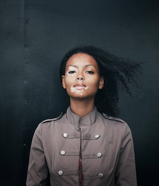 gyönyörű fiatal barna nő, vitiligo betegség - Fotó, kép