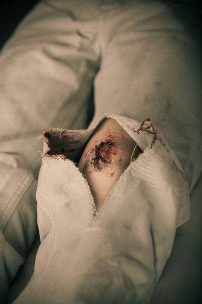 Close up van gescheurde broek met grote bloeden snee - Foto, afbeelding