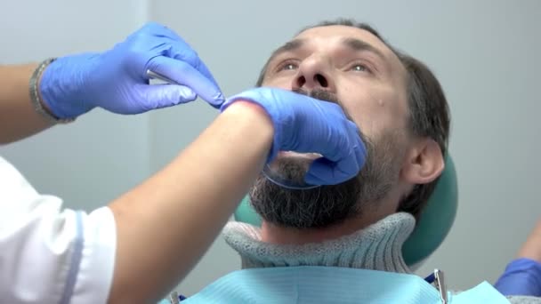 Patiënt met tandheelkundige mond opener. - Video