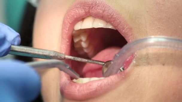 Geopende mond en tandheelkundige instrumenten. - Video