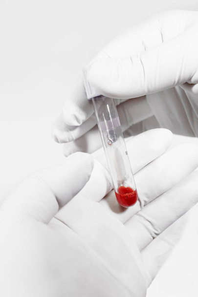 blood testing in laboratory  - Foto, imagen