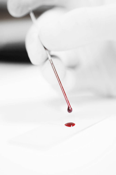 análisis de sangre en laboratorio
  - Foto, imagen