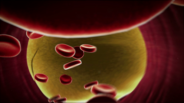 Fettzellen im Blut - Filmmaterial, Video
