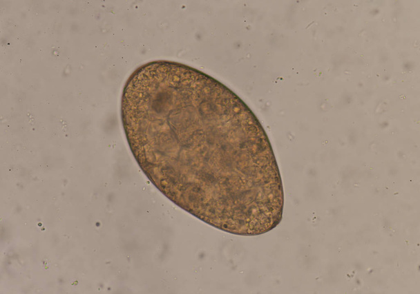 Egg of parasite in stool exam. - Photo, Image