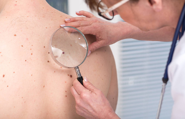Dermatologe untersucht die Haut eines Patienten - Foto, Bild