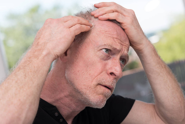 Senior férfi hajhullás aggodalomra ad okot - Fotó, kép