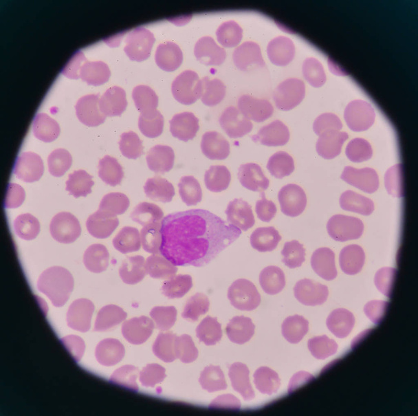 globules blancs sur fond de globules rouges
. - Photo, image
