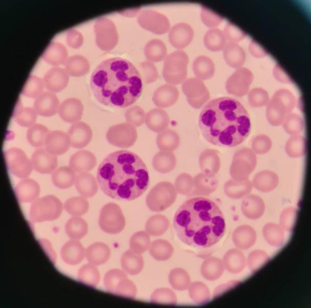 Glóbulos blancos en el fondo de los glóbulos rojos
. - Foto, imagen