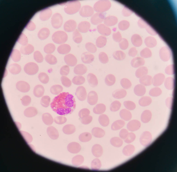 Λευκά κύτταρα του αίματος σε ερυθρά αιμοσφαίρια φόντο. - Φωτογραφία, εικόνα