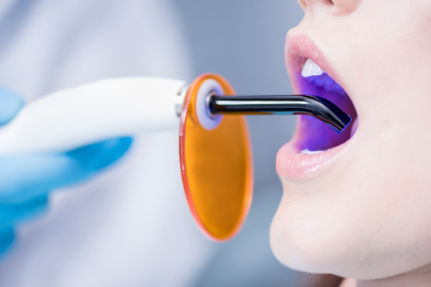 patient and dental curing light - Photo, Image