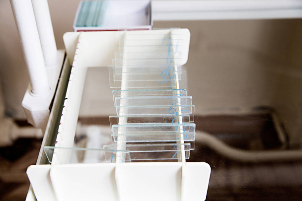 Laboratório de vidro deslizante com esfregaço ginecológico
 - Foto, Imagem