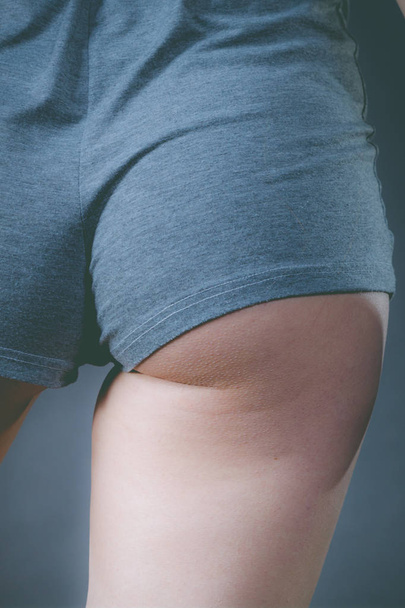 Woman wearing grey shorts showing her buttock. - Valokuva, kuva